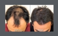 Cosmetic Surgery west palm beach