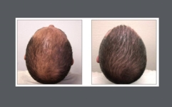 Cosmetic Surgery west palm beach