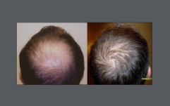 Cosmetic Surgery west palm beach