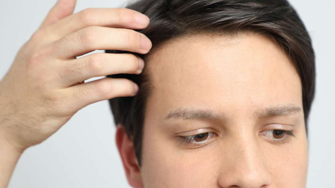 5 FAQs About Hair Restoration in Palm Beach