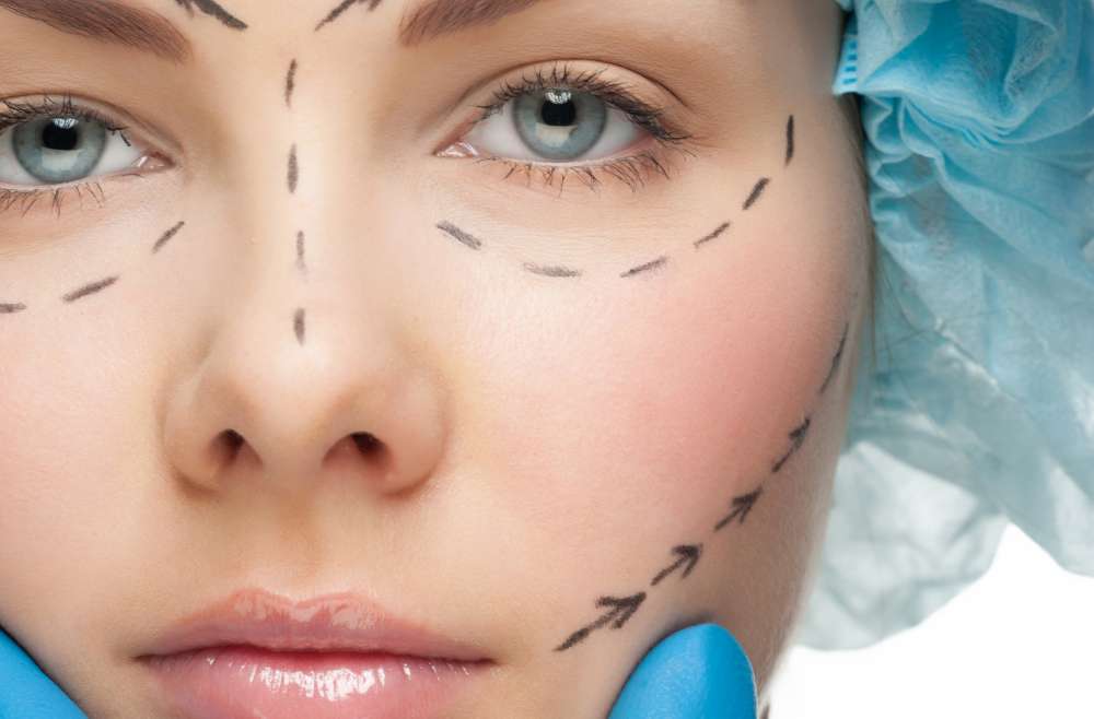 Vivace Micro-needling RF in Boynton Beach