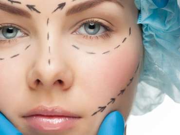 Vivace Micro-needling RF in Boynton Beach