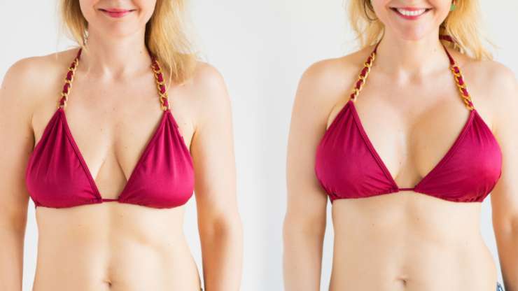 Where Can I Get a Mommy Makeover in Boynton Beach?