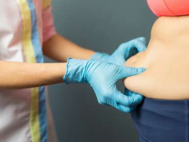 Where Can I Get a Mommy Makeover in Wellington